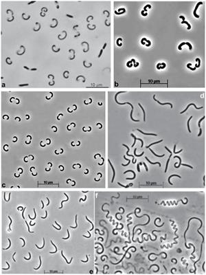 Phenotypic and Genomic Properties of a Novel Deep-Lineage Haloalkaliphilic Member of the Phylum Balneolaeota From Soda Lakes Possessing Na+-Translocating Proteorhodopsin